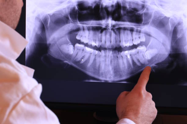 Best Tooth Pain Emergency Relief  in Savannah, TX