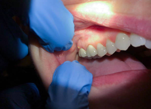 Best Cracked Tooth Emergency Dentist  in Savannah, TX