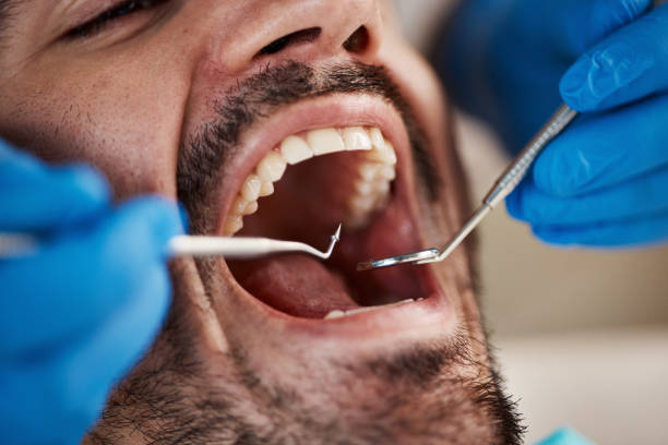 Best Emergency Tooth Extraction  in Savannah, TX